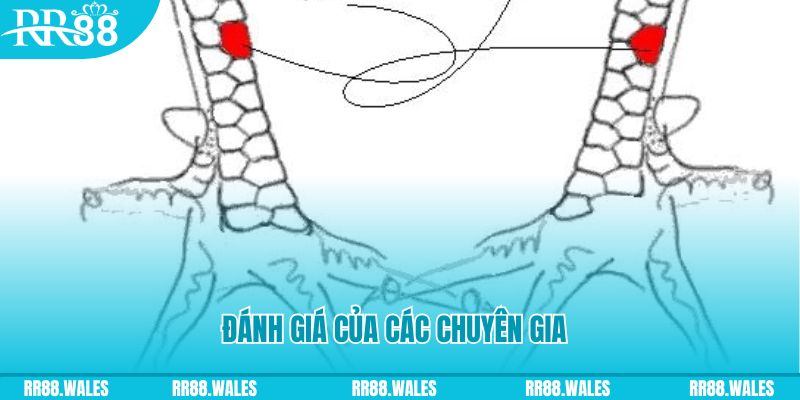 Đánh giá của các chuyên gia về vảy vấn cán